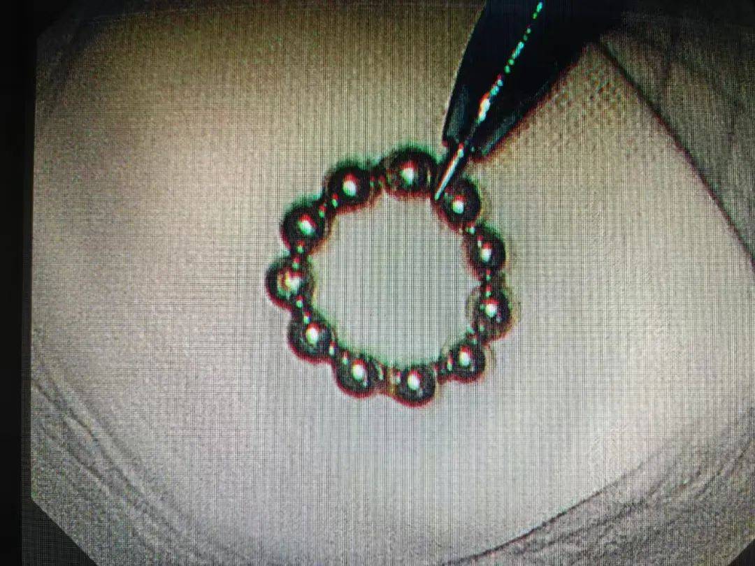 磁力球孩子吃了是什么反应_磁力球吃了会怎么样（儿童吃磁力球到肚子里了能排泄出来吗）