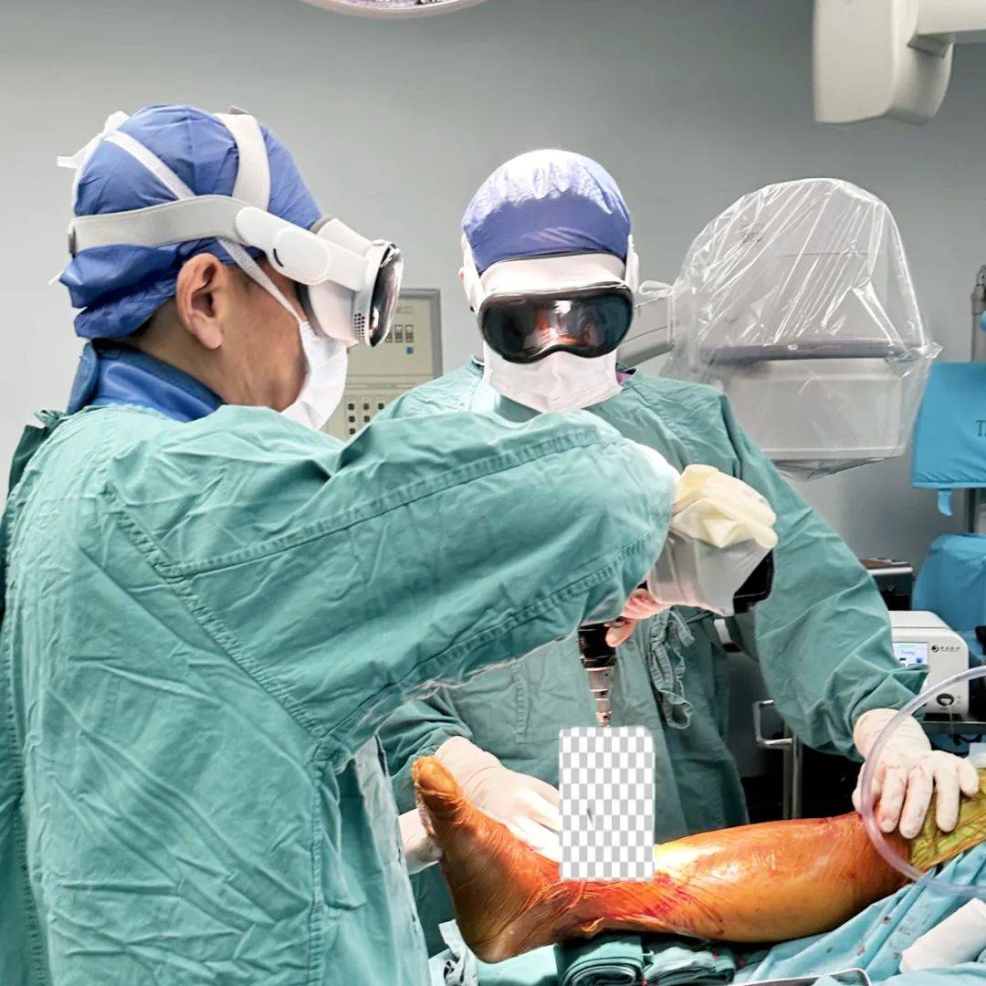 全球首次!全视觉混合现实ai实时跟踪配准辅助骨科手术在湘雅医院开展