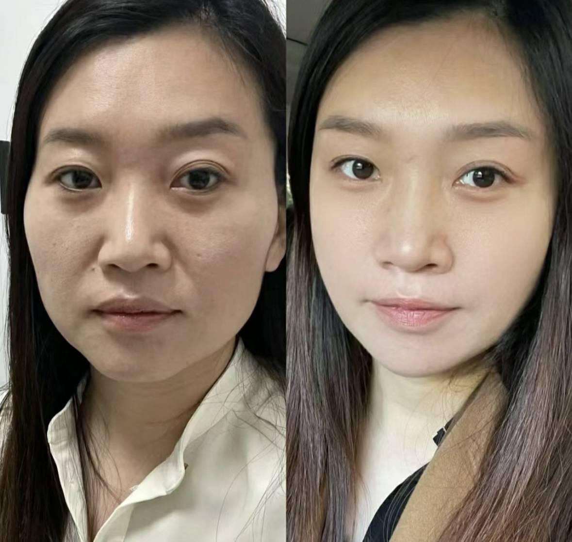 抗皱紧致护肤品哪款好?推荐:抗皱紧致护肤品排行榜前十名