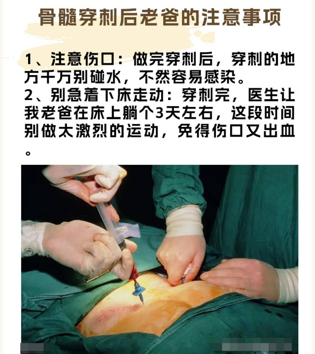 北京知名中西医结合血液病专家史淑荣院长指出,骨穿次数因病情阶段