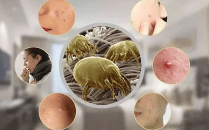 2025除螨仪十大名牌:床上除螨仪十大名牌排行榜综合分享