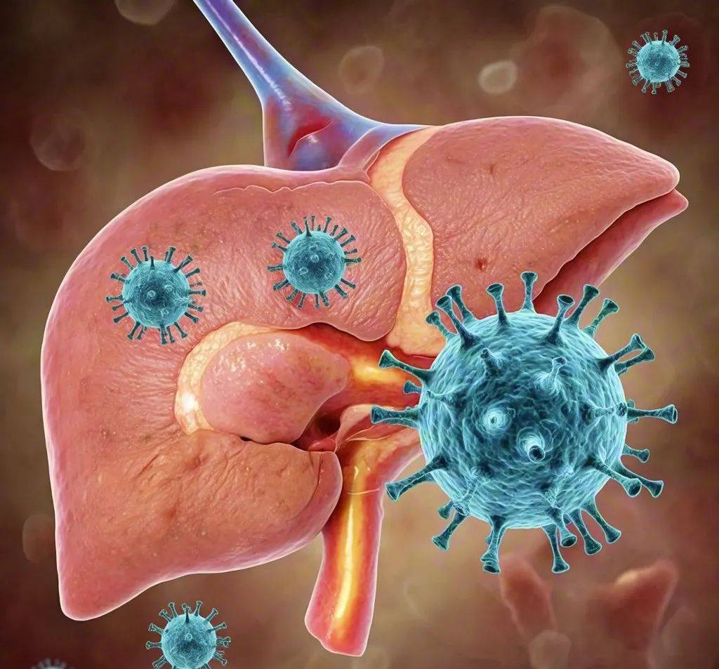 小心吃出来的甲型肝炎!