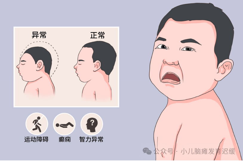 脑发育不良孩子姿势异常,语言表达差,家属接下来如何做?