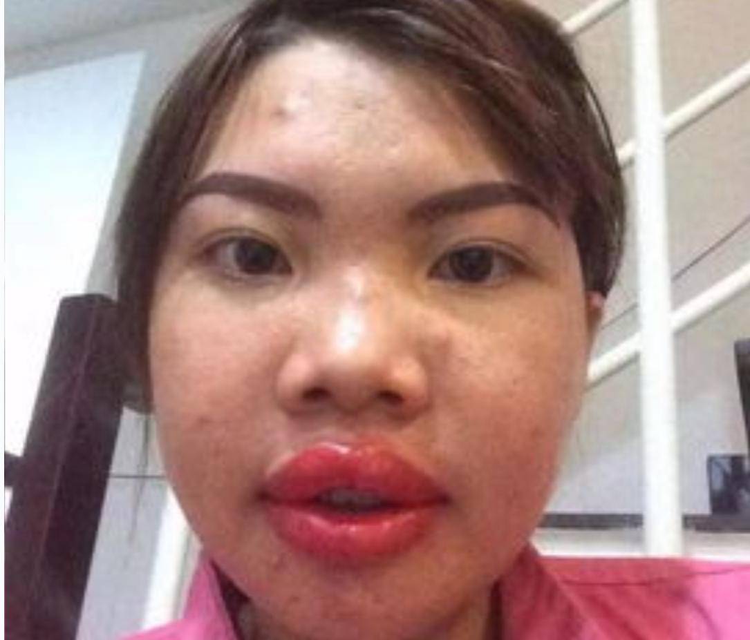 越南凤姐为变美砸10万整容,嫁给富二代后现原形被甩,如今怎样了