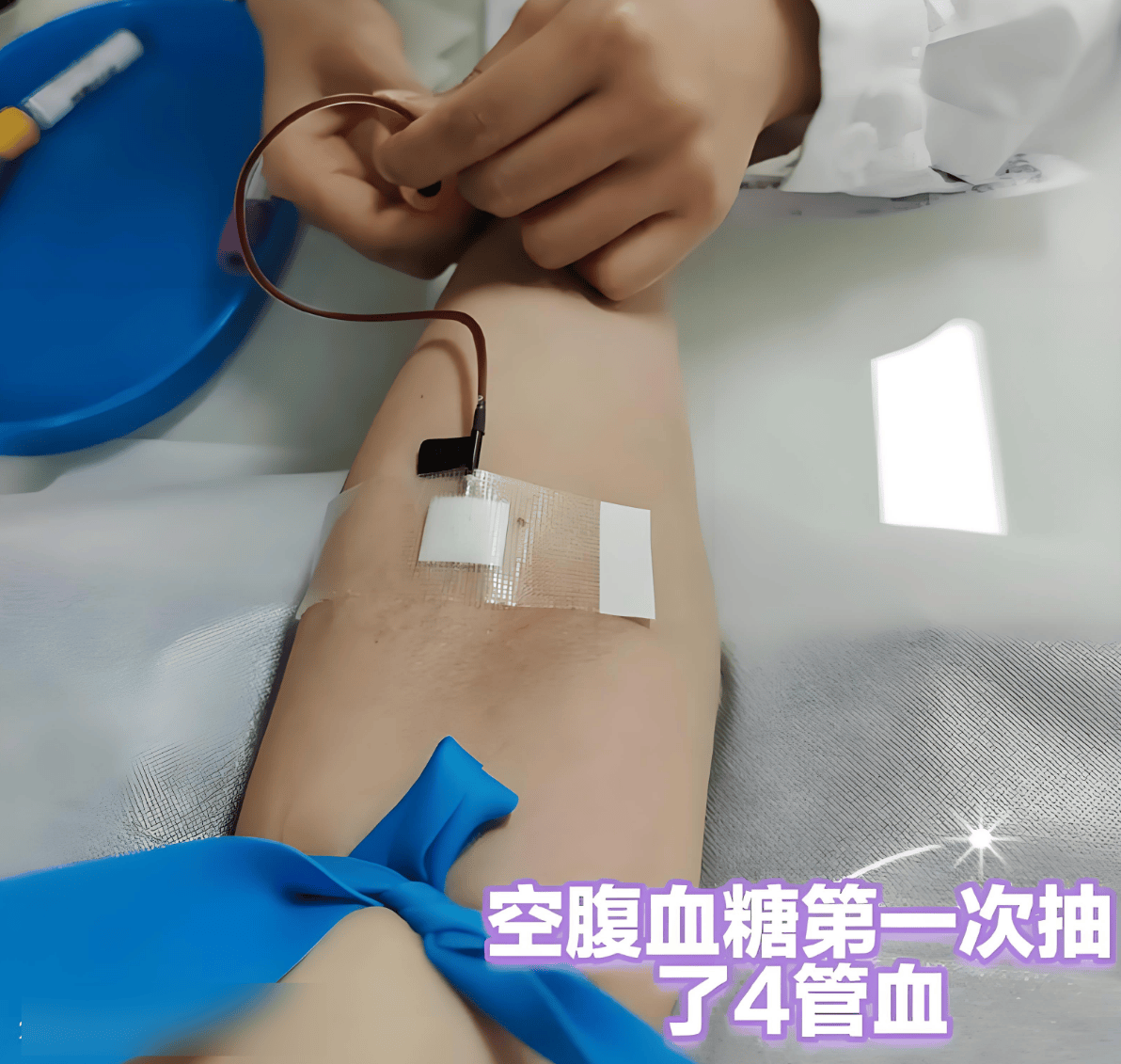 怀孕期间血糖高有什么症状？孕妈们多留心