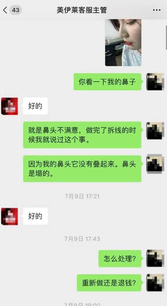 消费者在昆明美伊莱遭遇维权冷暴力:五万元隆鼻索赔无门(图2)