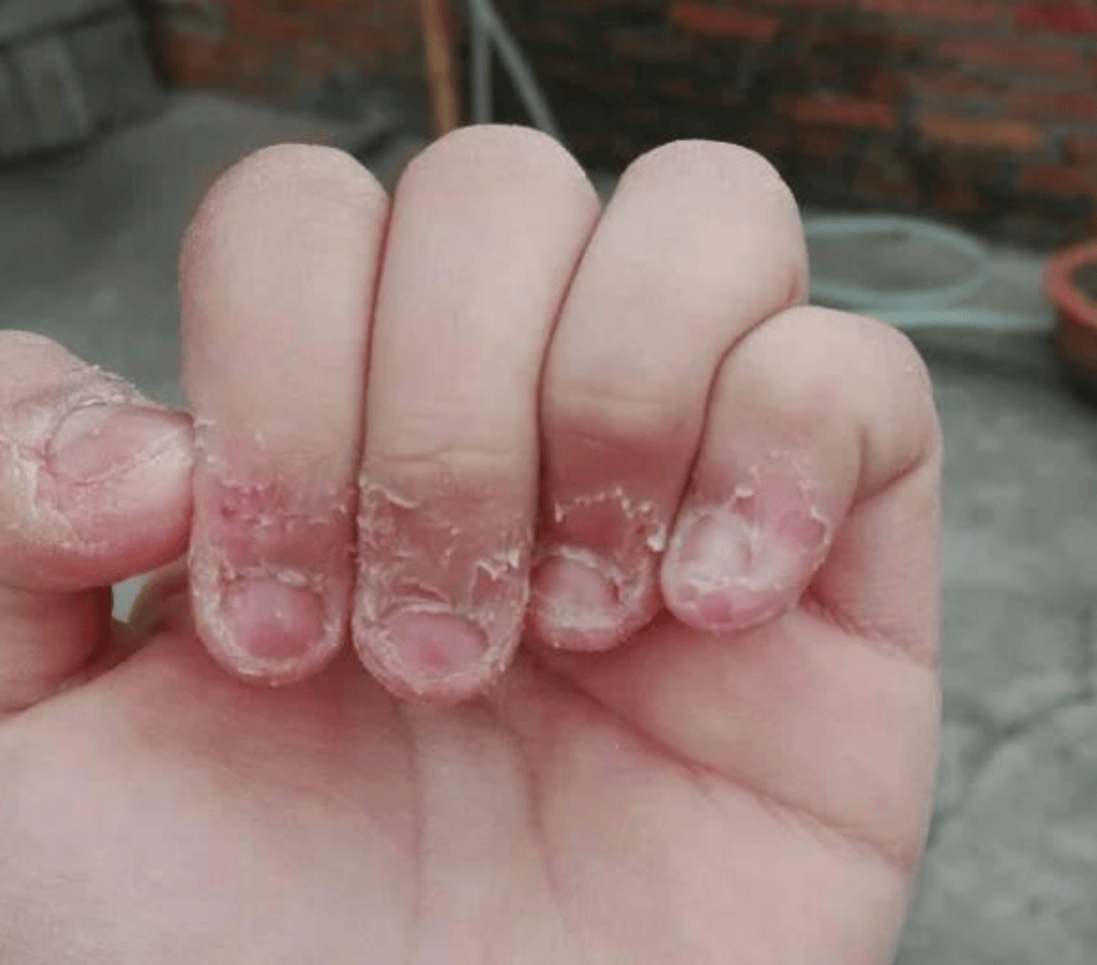 喜欢啃指甲的孩子,长大后可能难逃两种结局,全是爸妈不想看到的
