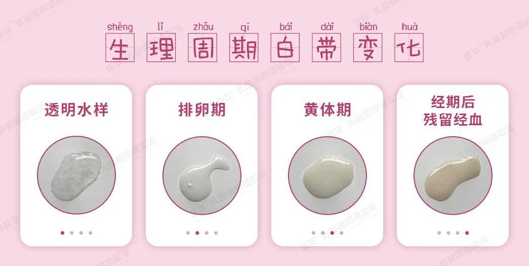 白带异常不要慌张,什么样白带才是正常的,教你居家自检