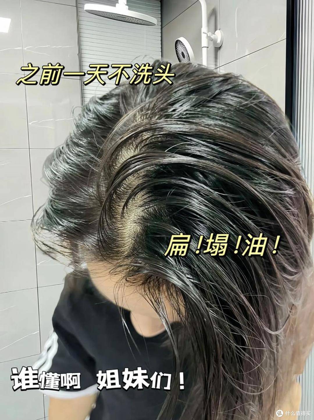 选对它头皮清爽超舒服