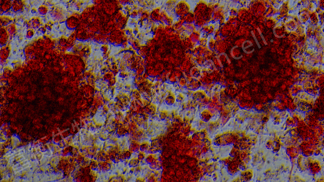 破骨细胞"身份证":trap染色为何成为金标准?