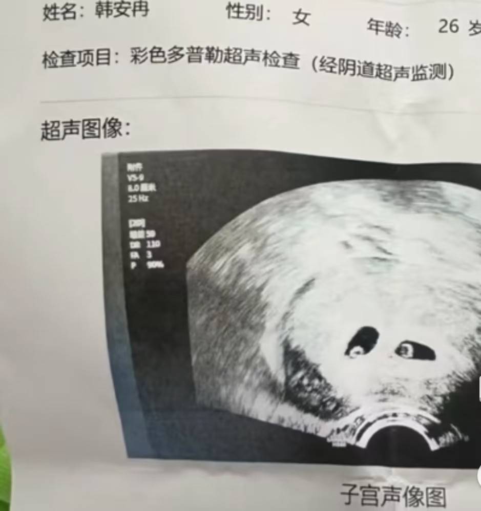 她解释道,如果第三胎是女孩,虽然她不会选择继续怀孕,但她会好好抚养