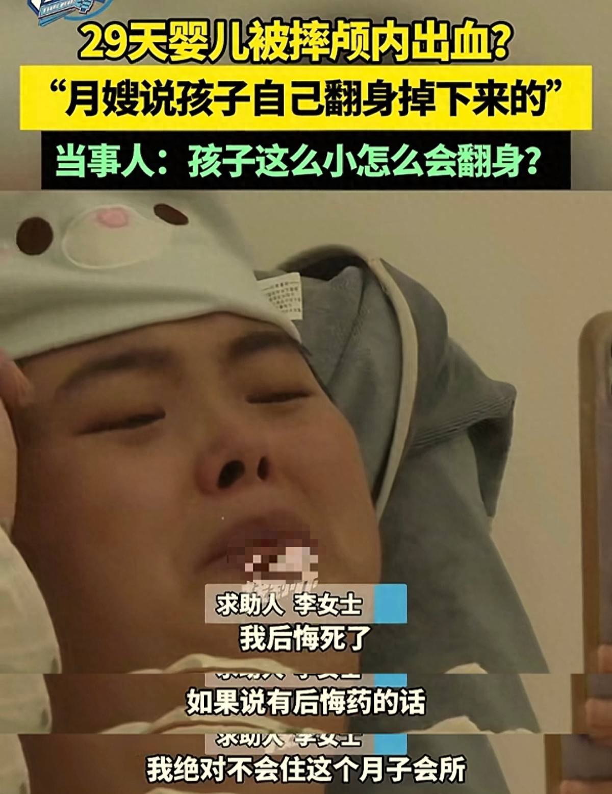 29天婴儿被摔颅内出血,月嫂说孩子自己翻身掉下来的