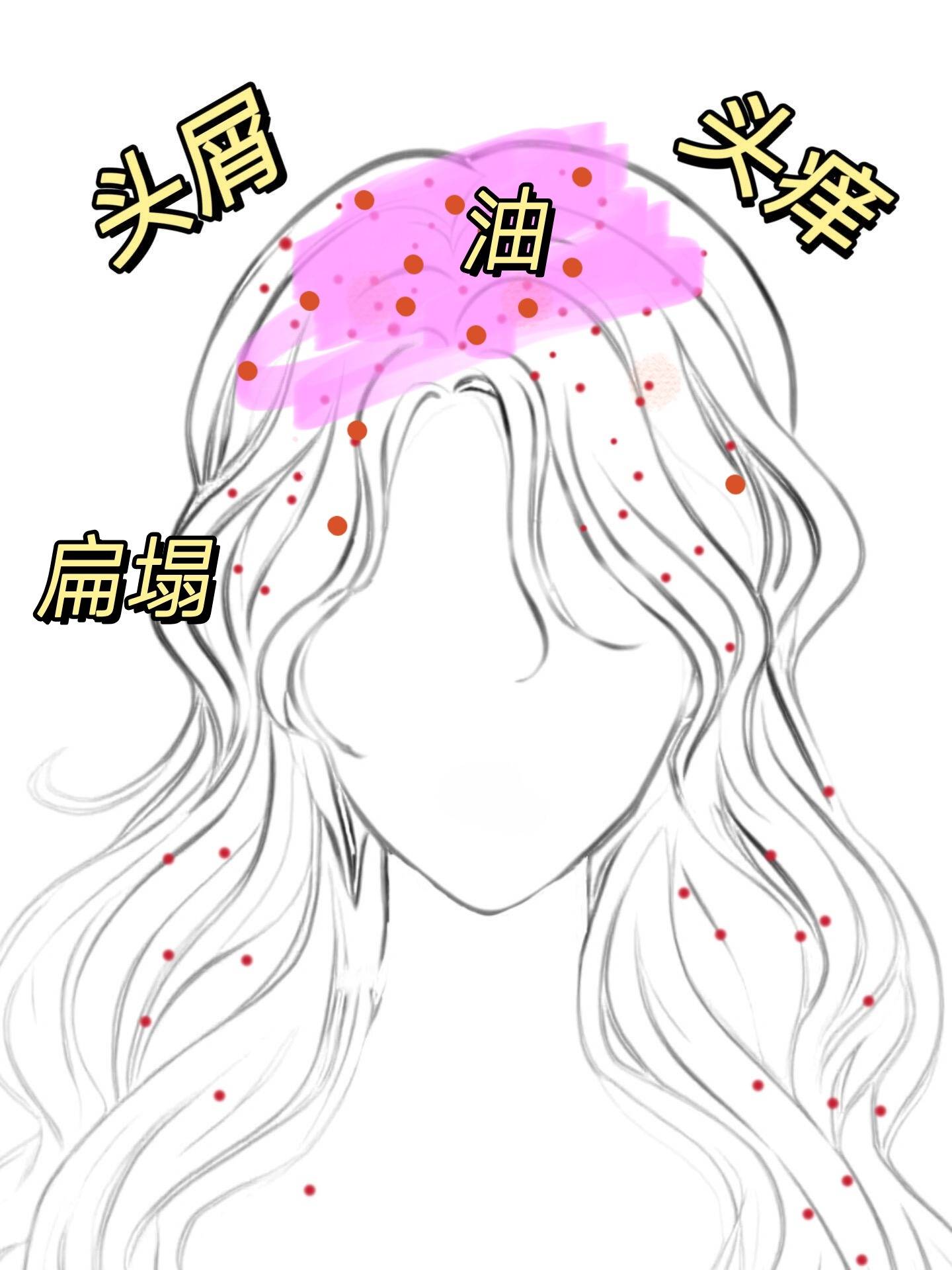 公认最有效的去屑洗发水