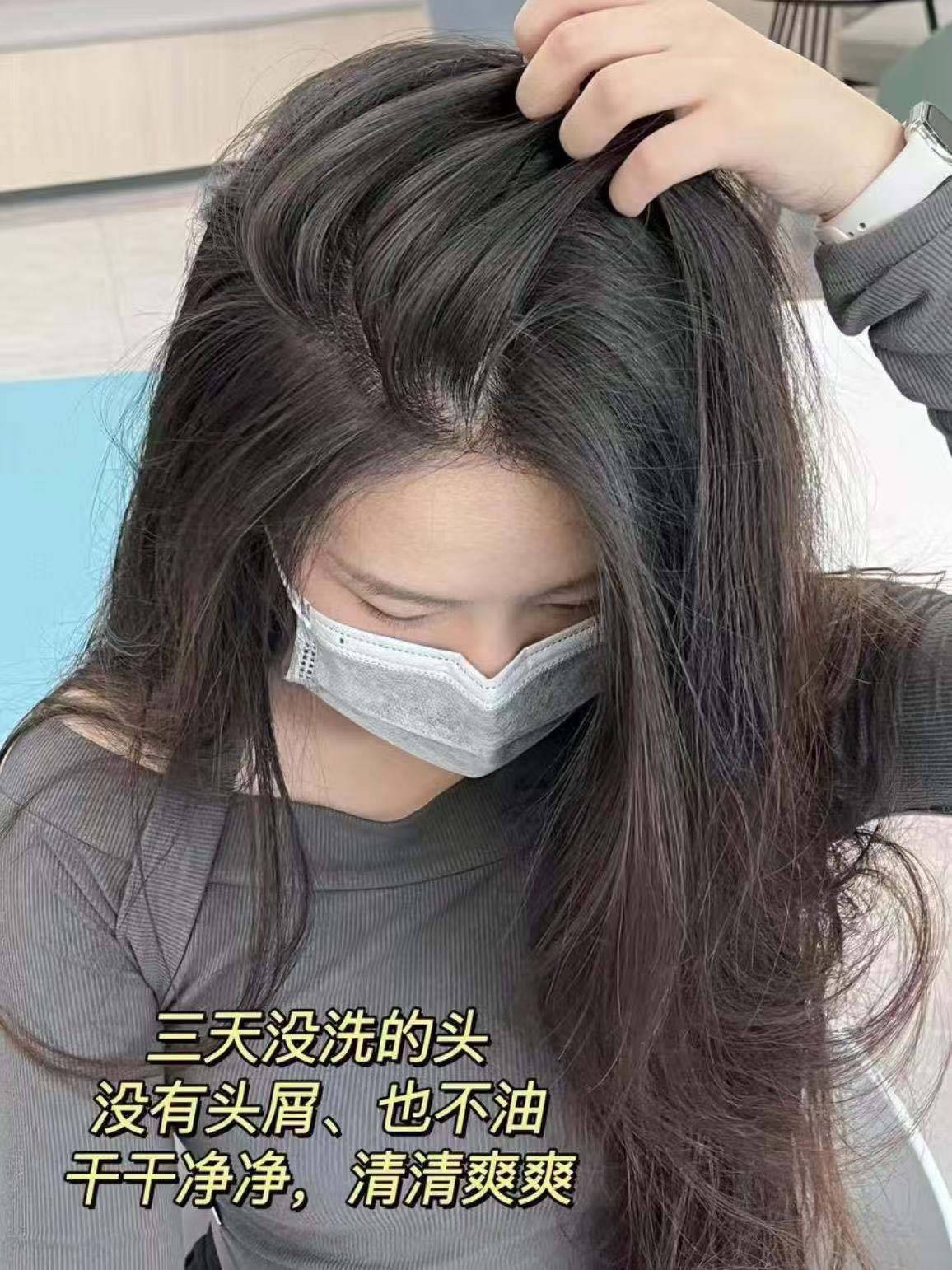 头油头皮屑多头痒用什么洗发水什么洗发水去屑好推荐?