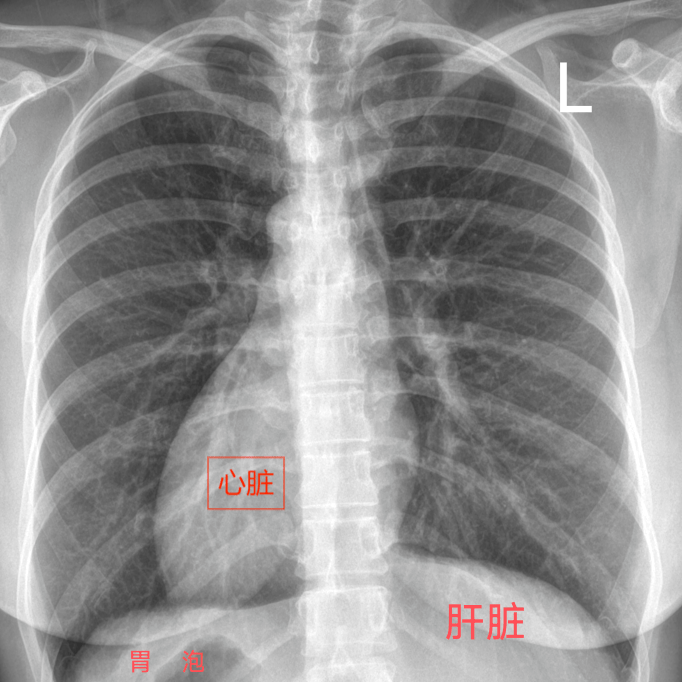 李大爷_心脏_患者