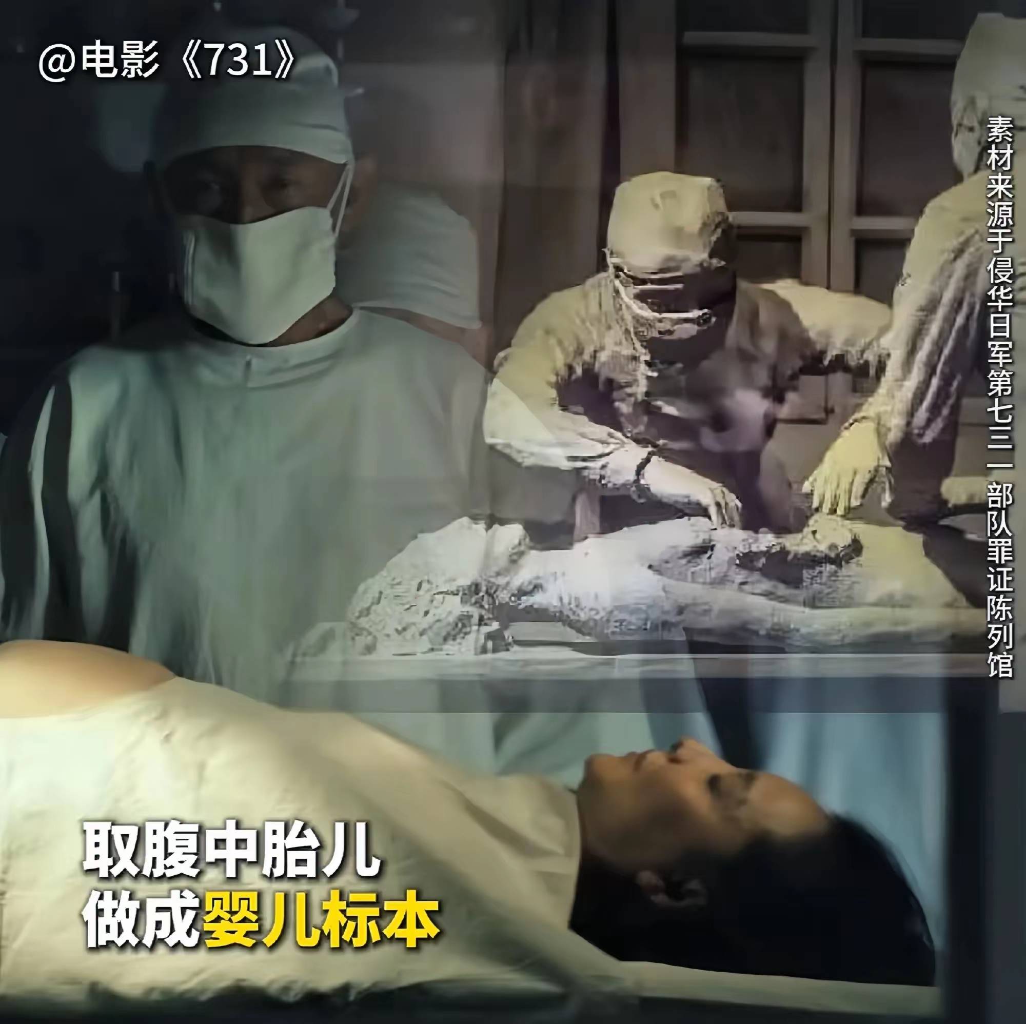 《731》剖腹取婴后续:婴儿是导演赵林山女儿,父母太"残忍了"