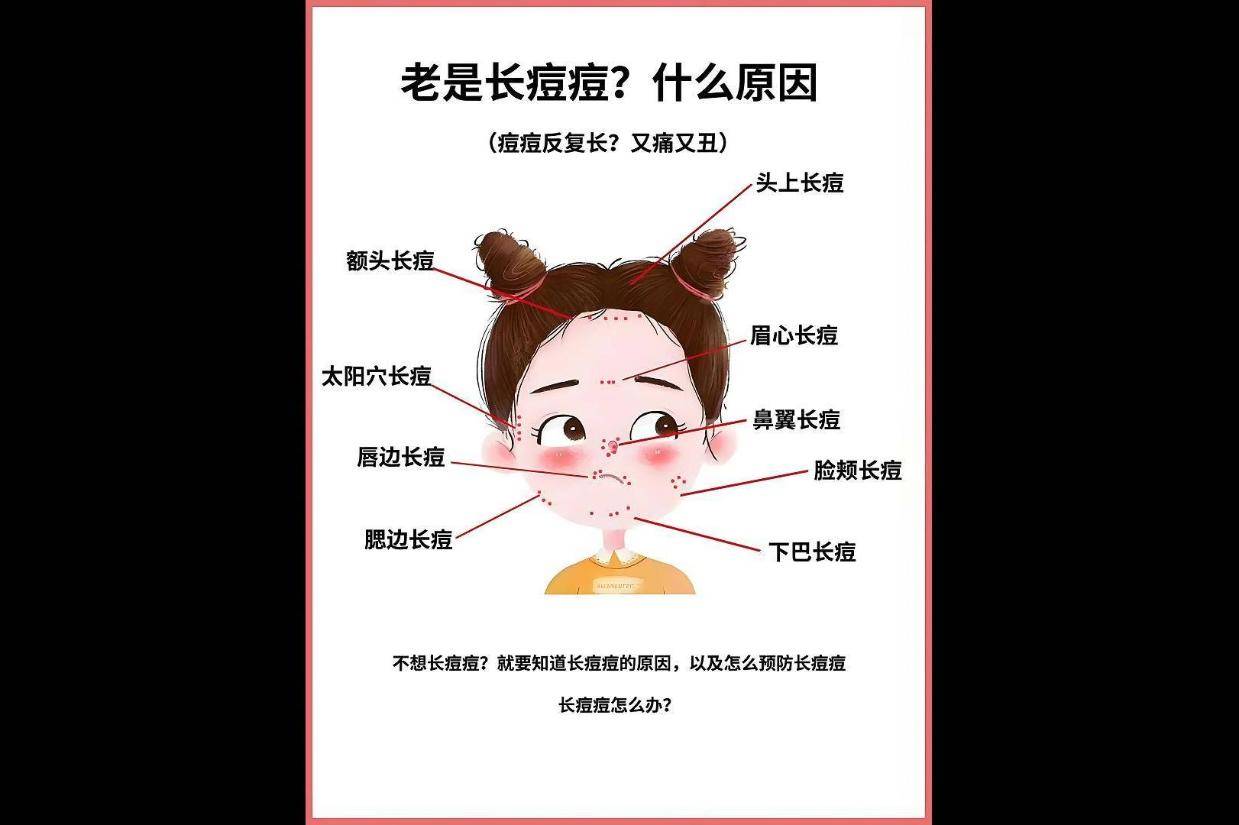 为什么总是长痘