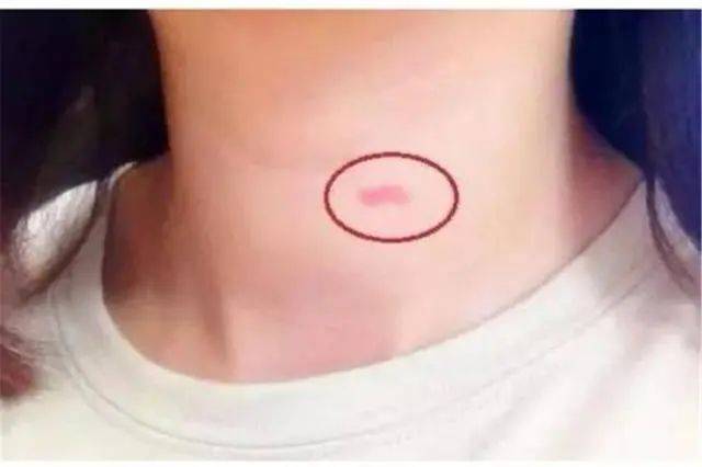 14岁女儿脖子出现草莓印,妈妈没急着问,仅用了一招女儿主动认错