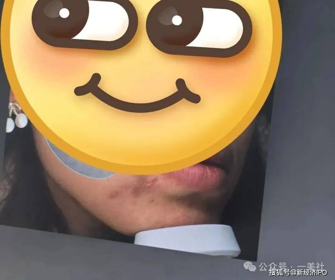 16万元手术后致消费者脸部畸形 南医大友谊整形身陷信任危机(图5)