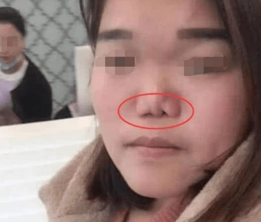 孩子老爱挖鼻孔,究竟是为啥？知道原因后家长要及时制止