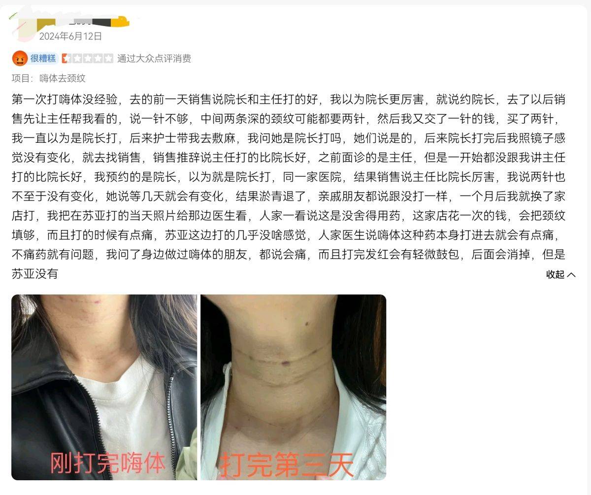 曾偷税488万元的无锡苏亚再遭差评:消费者不满效果和推销(图13)