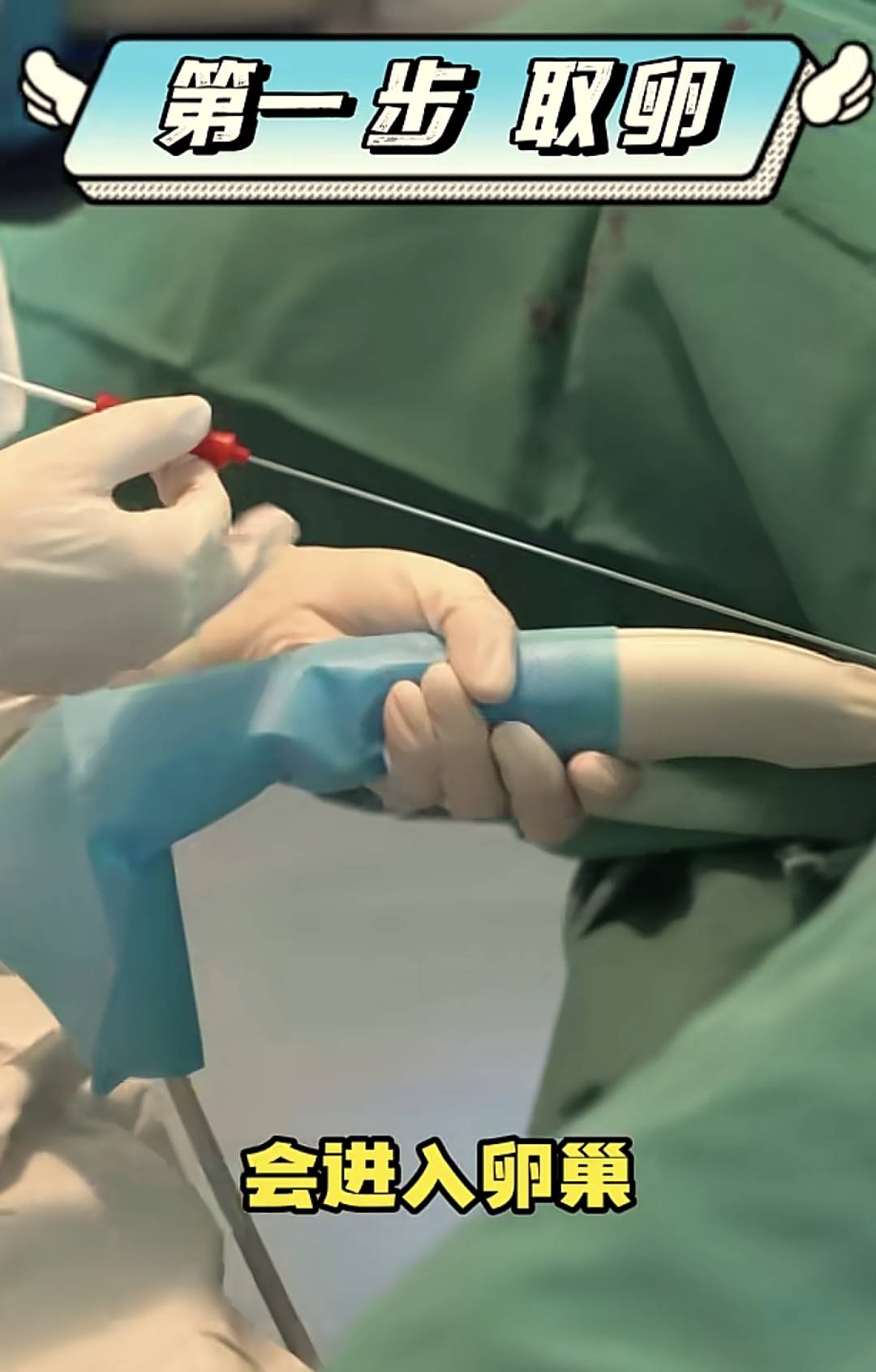 一组生殖科医生日常工作图揭露试管婴儿的奥秘：都是女的受罪