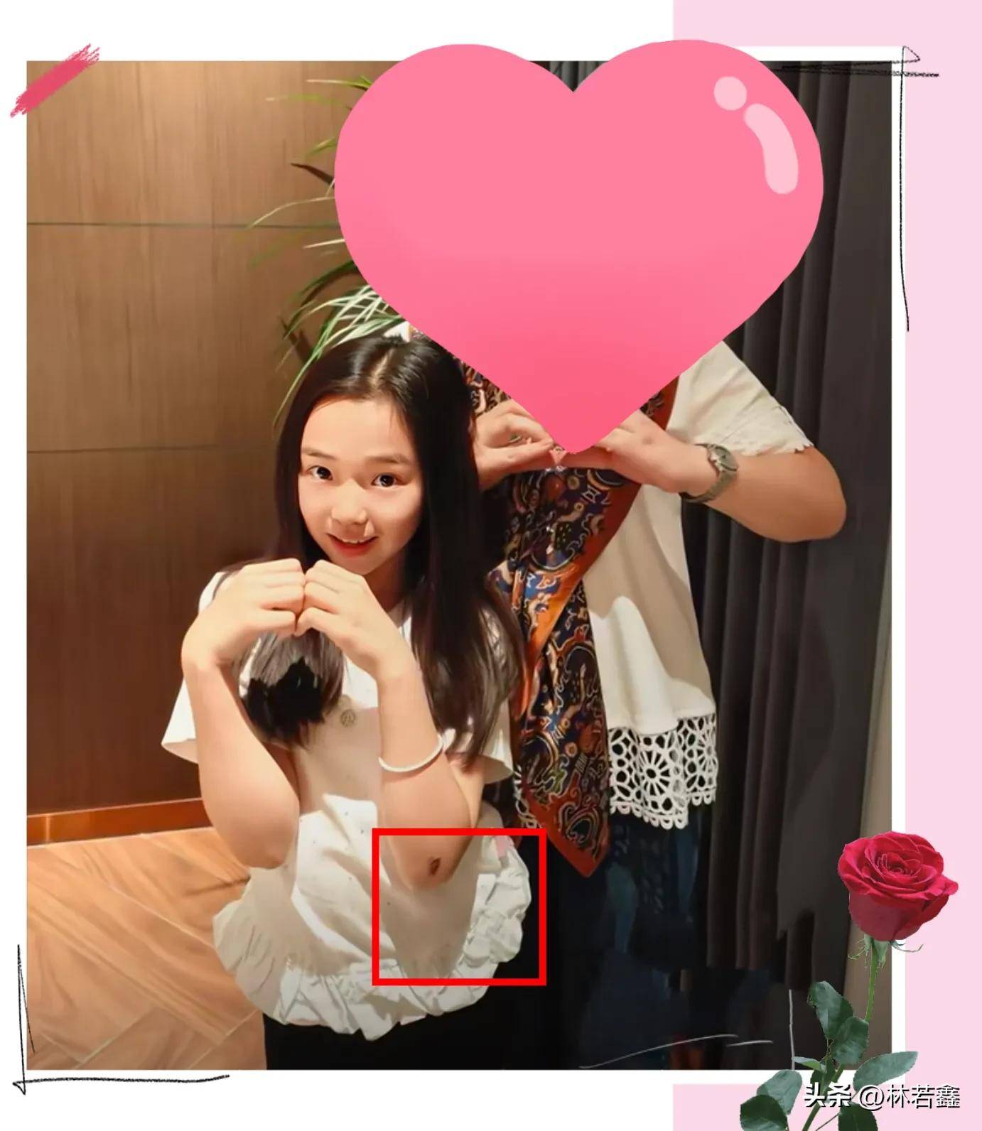 董璇一家与朋友聚餐张维伊背后抱着董璇很甜蜜小酒窝手臂受伤