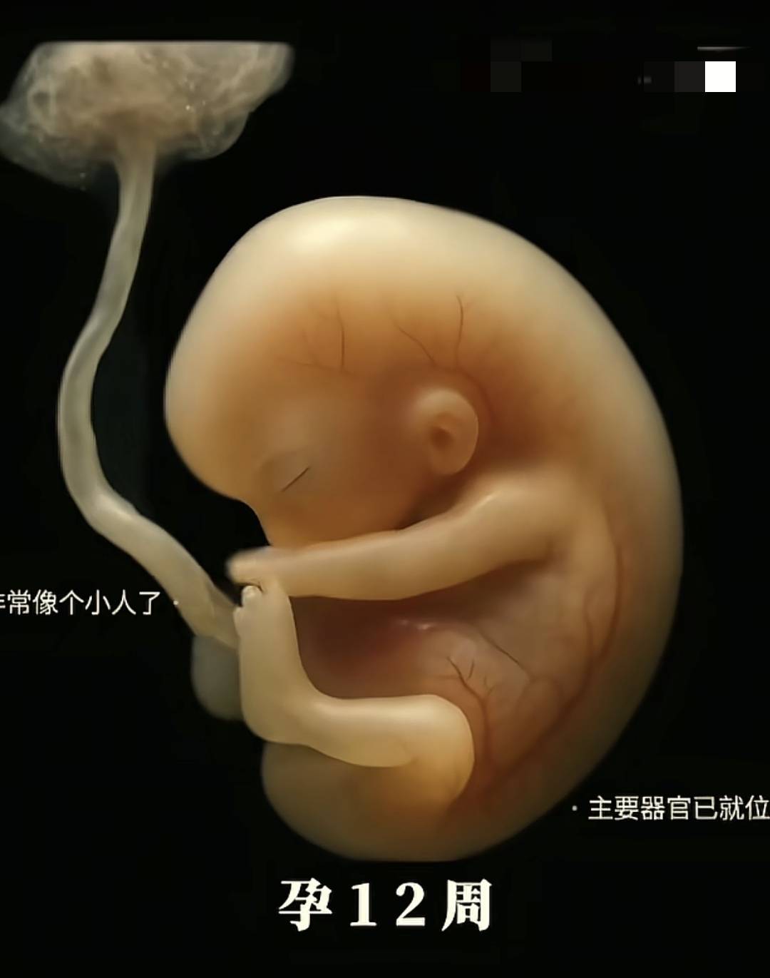 从胚胎到变成胎儿这个孕早期的过程到底是怎么样的？