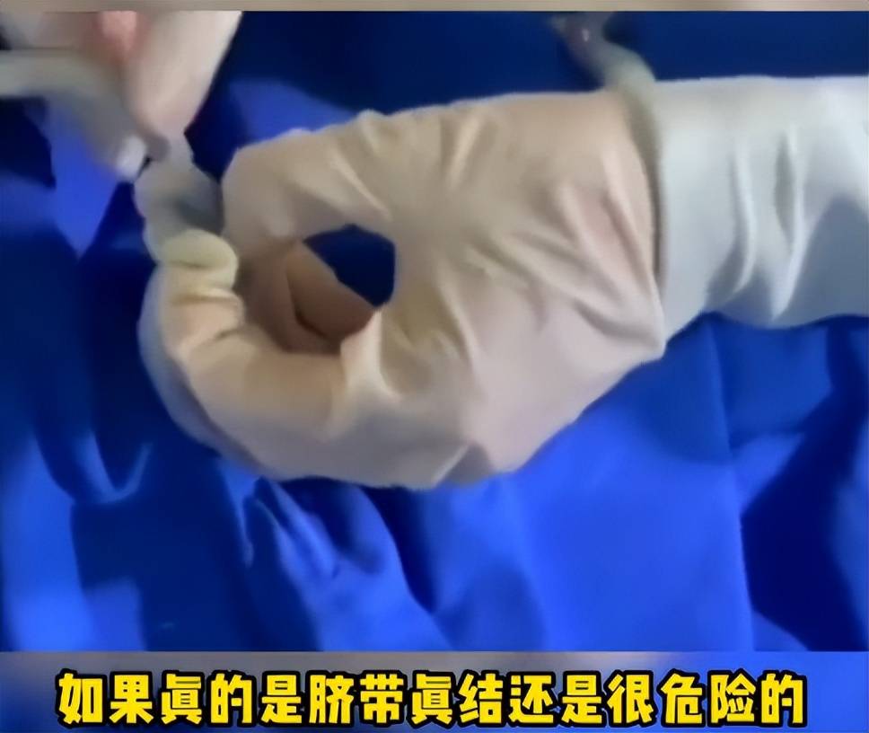 孕晚期要注意这4点,关键时刻能救命!