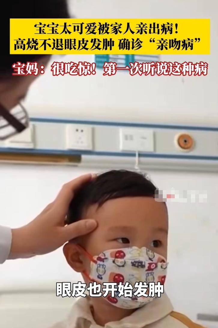 奶奶频繁亲吻孩子致其确诊亲吻病,导致10岁男孩脖子长肿块