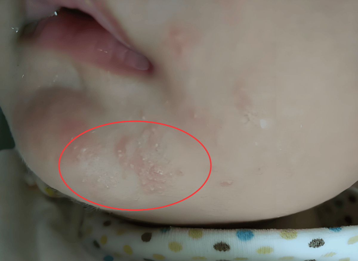 这些孕妇喜欢吃的食材,可能引发胎毒,怀孕后少吃