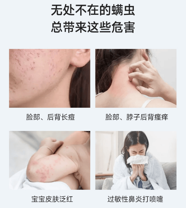 除螨仪哪个品牌好？公认好用的除螨仪有哪些？高口碑除螨仪十大品牌排名最新，避雷专场！