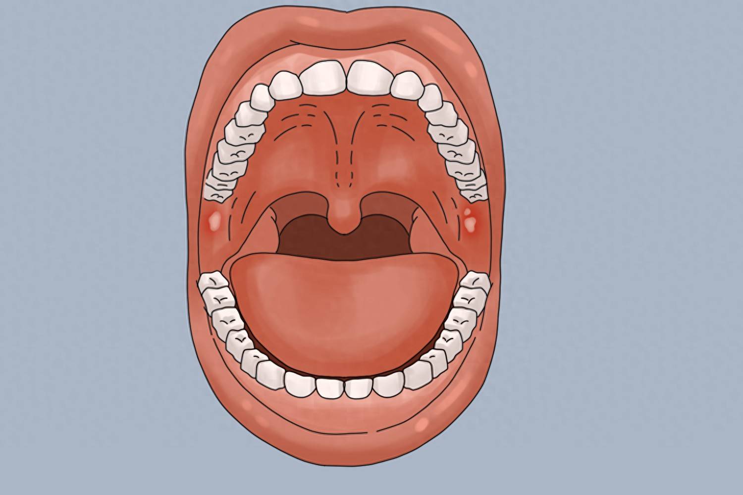 原创            口腔癌超六成患者确诊时已是中晚期，早期治疗，5年生存率超80%