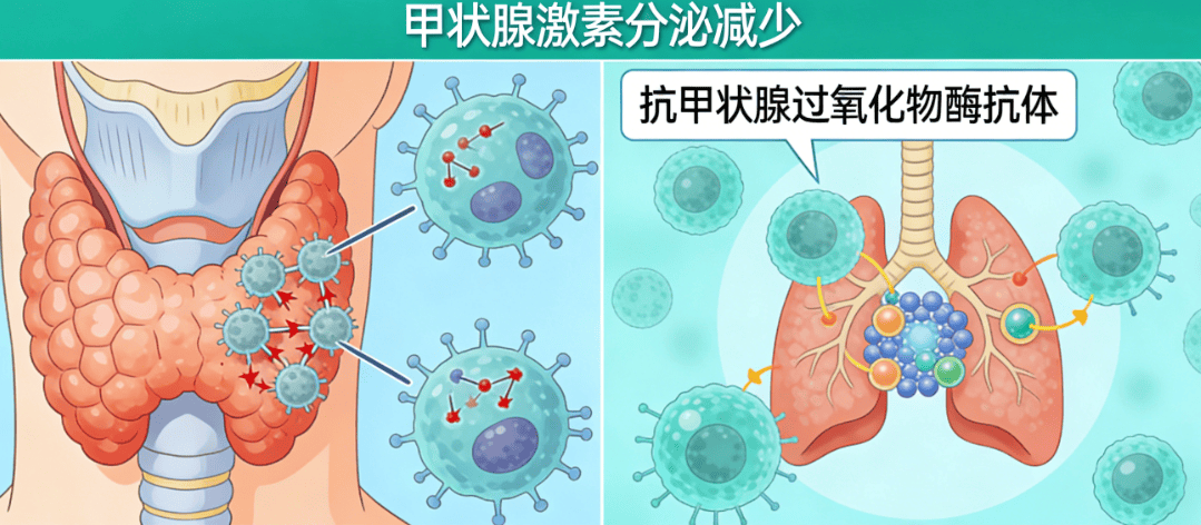 桥本甲减≠普通甲减！很多人不知道这3点区别，尤其夜间4个症状