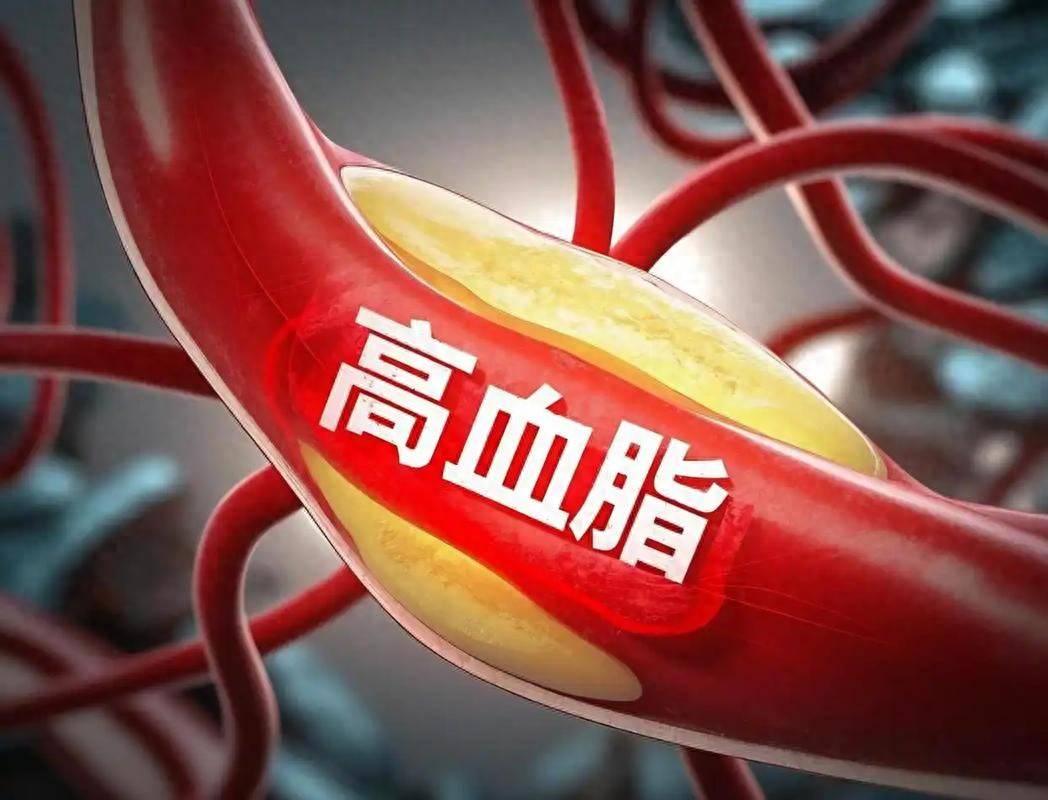 原创            你的血管正悄悄变窄，经常头晕乏力？手脚发麻？小心血脂异常