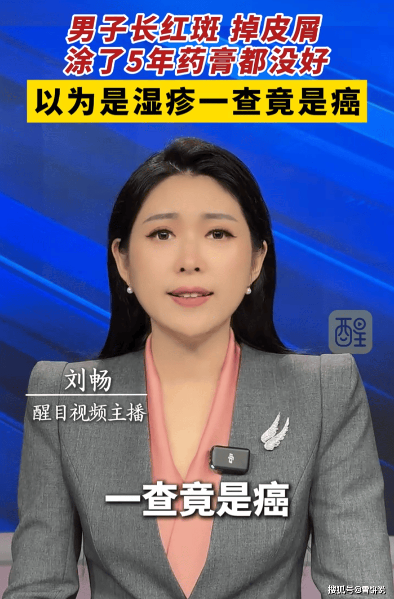 原创            男子把皮肤癌当湿疹治了五年，换过数种药膏都没好，活检才揭开真相