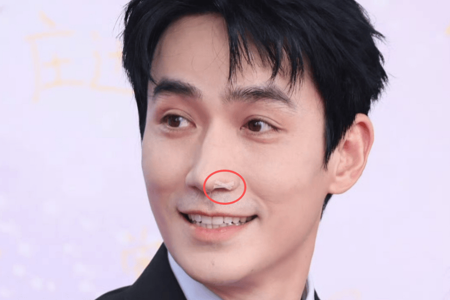 朱一龙拍动作戏鼻子受伤！已接受治疗，恢复情况良好工作调整