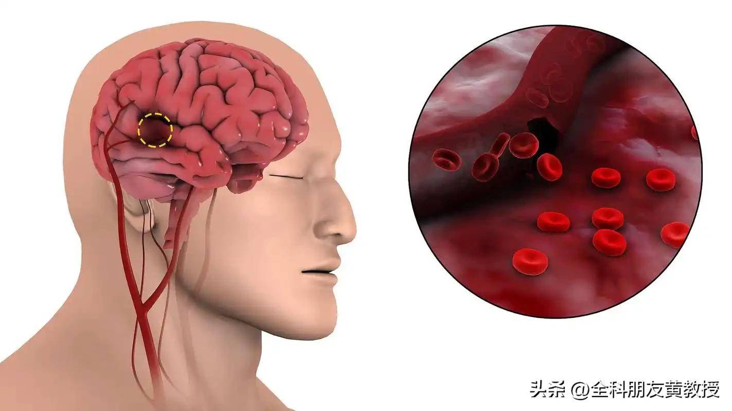 原创            大脑最危险信号，不是头晕，是睡觉频繁出现6个表现，别不当回事