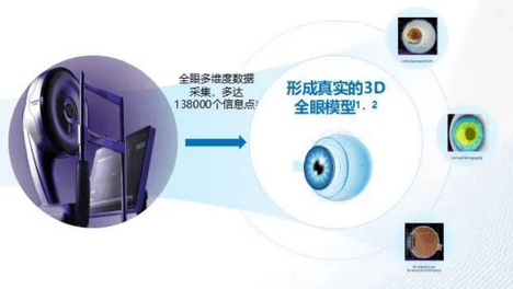 告别模糊，拥抱高清！贵港爱尔眼科“全光塑”技术，开启近视手术3D全眼定制时代
