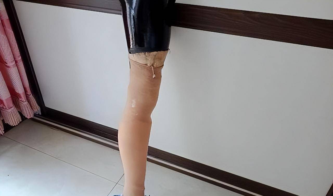 花百万抗癌七年,亲友劝母亲放弃,女孩:我凭什么就该死_妈妈_孩子_右腿