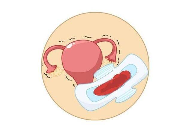 排卵性子宫出血对怀孕有影响吗?我有这种情况,该怎么办才好?