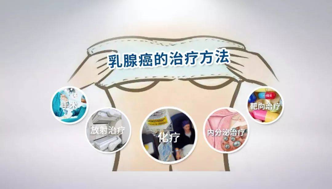 乳腺癌可以选择的治疗方法及慢病化管理_患者_手术_治愈