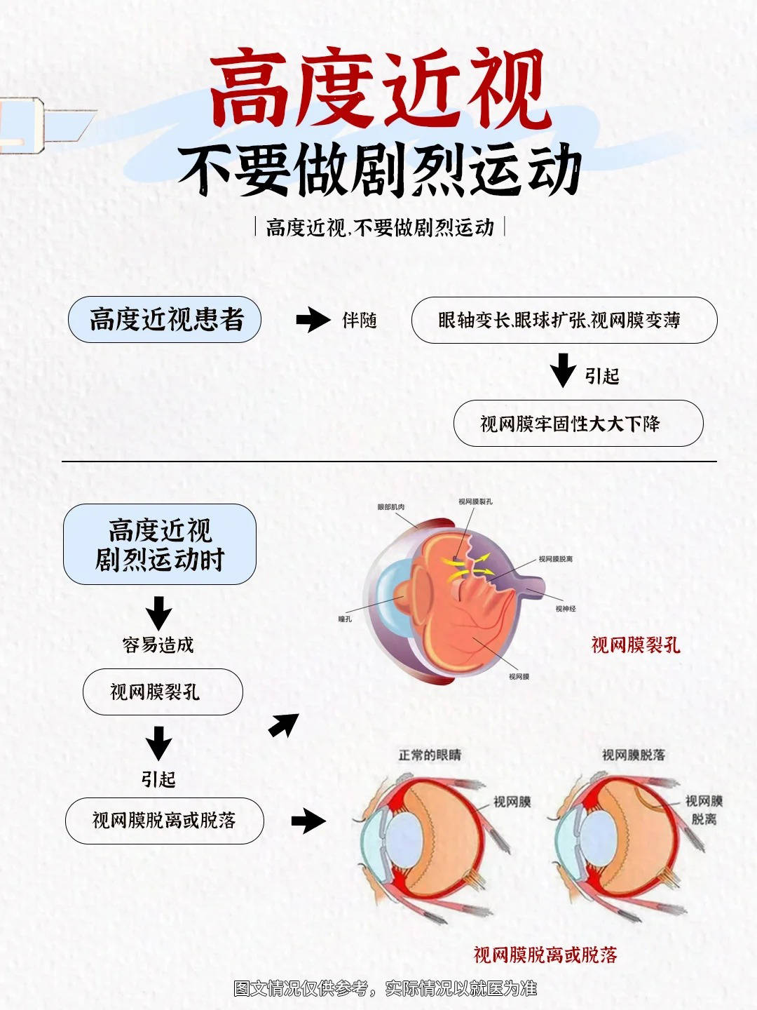 高度近视常做的一件事没想到这么危险_眼底_病变_并发症