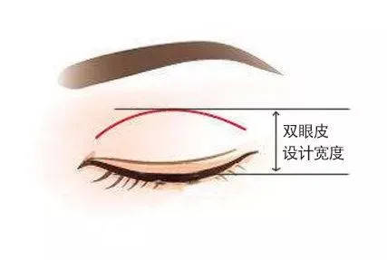 解析好看双眼皮美学标准 整形医生田鑫_眼睛_线条_眼窝