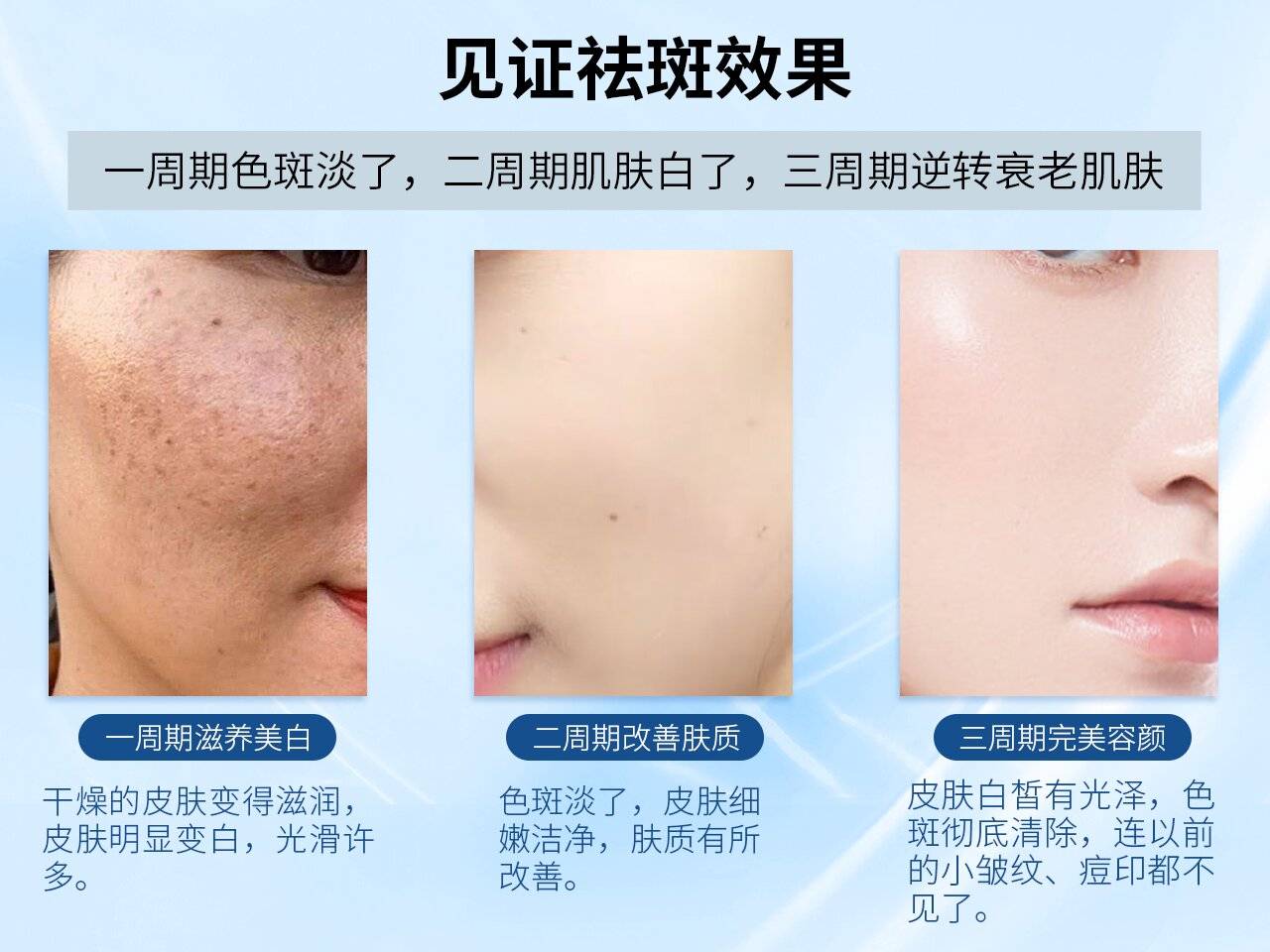 榜二:妍诗美美白淡斑套装颜值很高,主打的烟酰胺成分,美白水 精华液