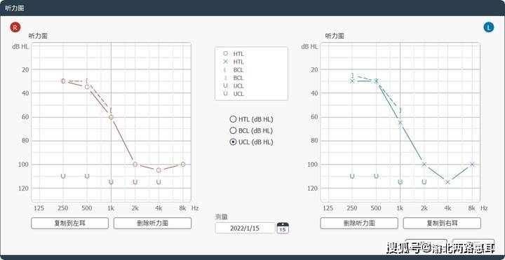 听力测试报告单图片