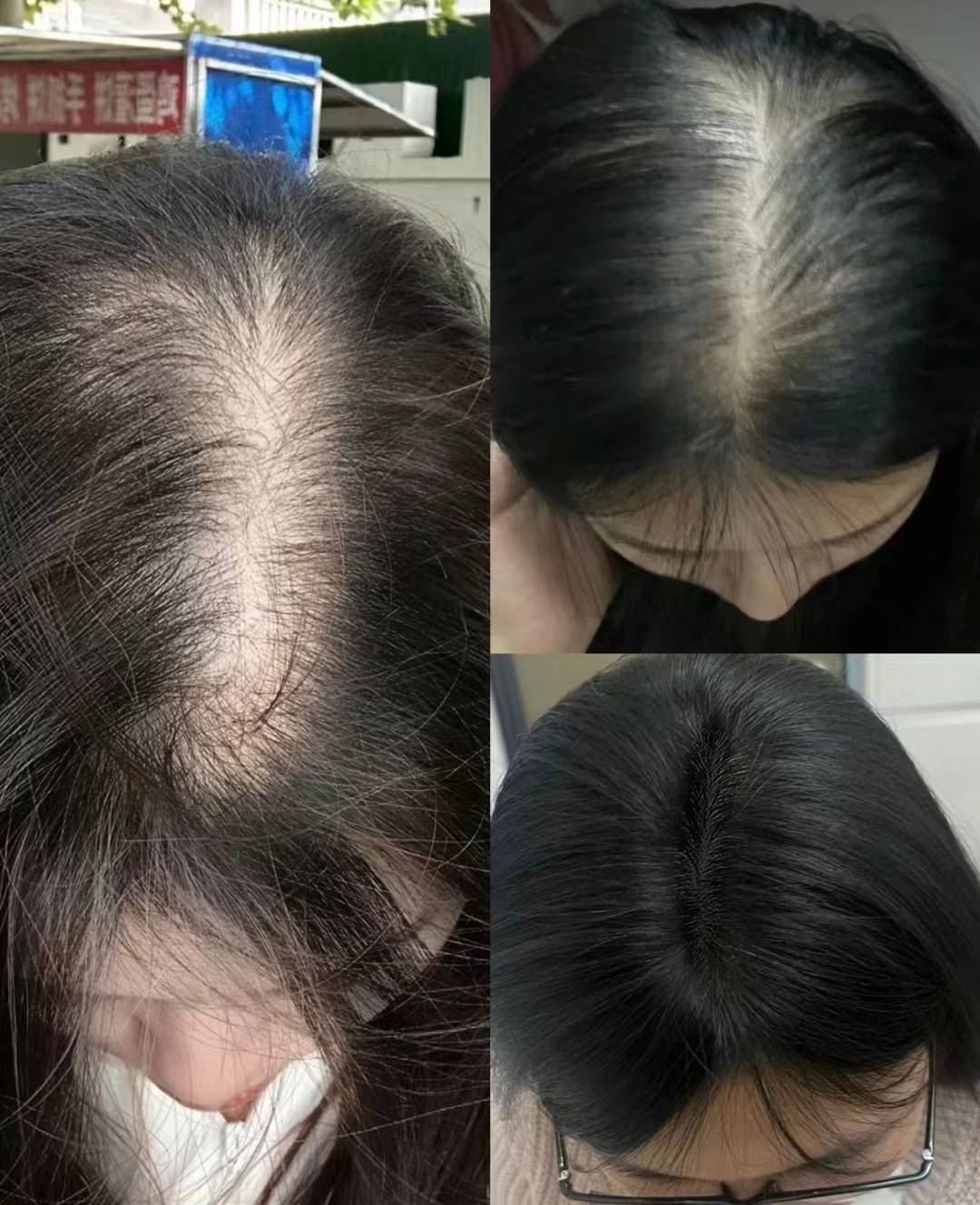 过来人3个有效育发妙招