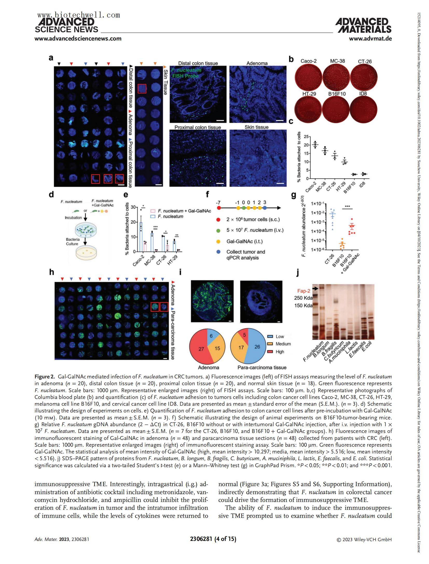 上海威奥直肠癌免疫组化文献11