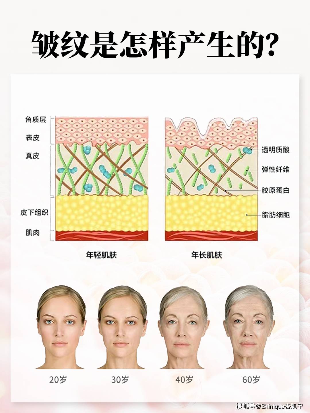 🦳皱纹科普大解密!皱纹是如何产生的?_皮肤_痕迹_科学