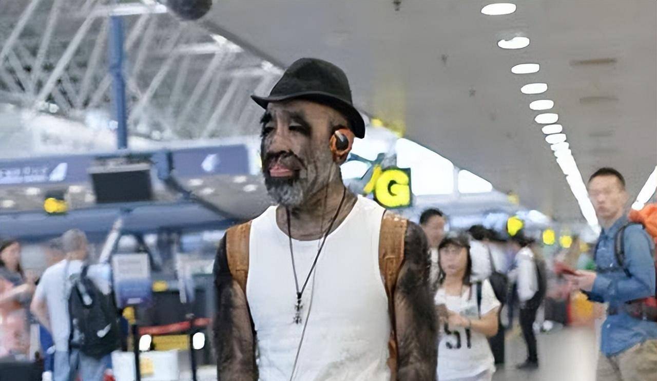 原创当年轰动一时的毛孩42岁娶90后娇妻生下一子未遗传长毛